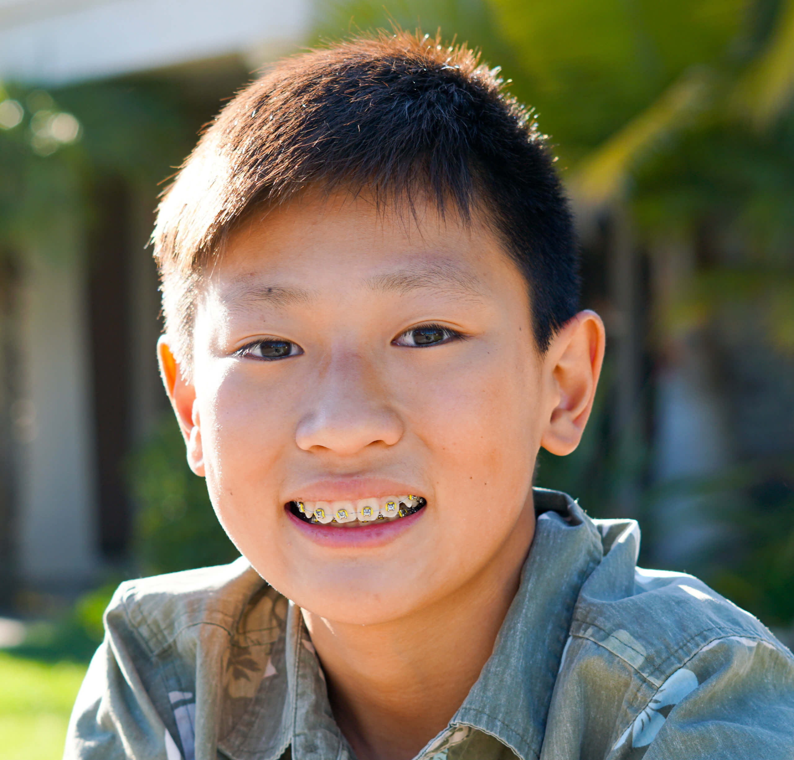 Portrait of young kid Asian boy with tooth braces. Young teen boy smiling and showing his orthodontic braces on his teeth.