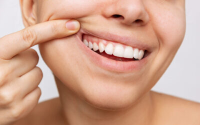 Unveiling the Secrets to a Perfect Smile: Tips for Achieving Teeth Alignment